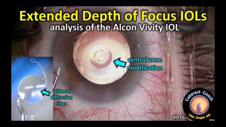 Alcon Lens Implant Mri Safety