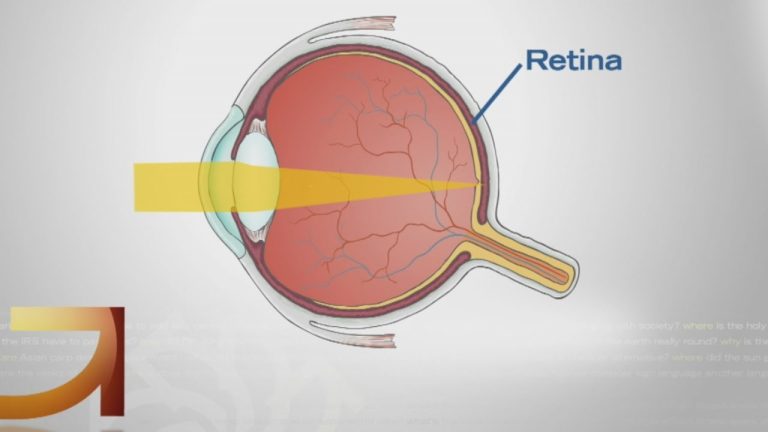 Are there contact lenses that work like sunglasses?