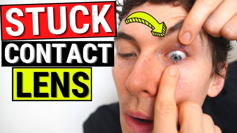 Can contacts cause dark circles?