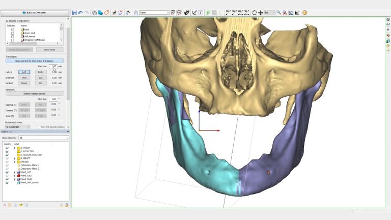 Define Materialise