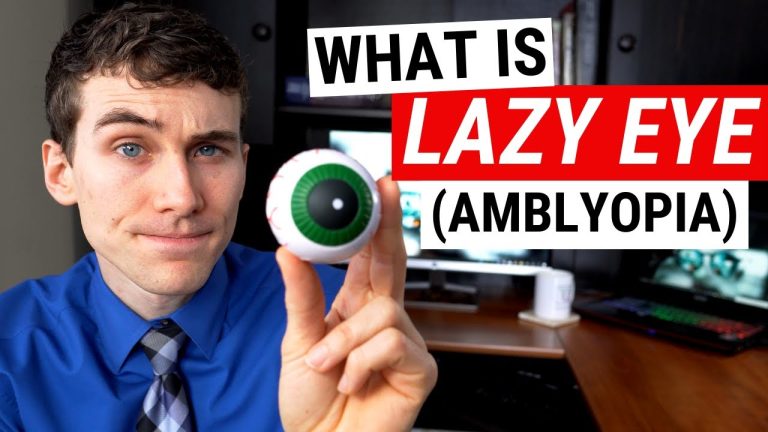 Does astigmatism cause lazy eye?