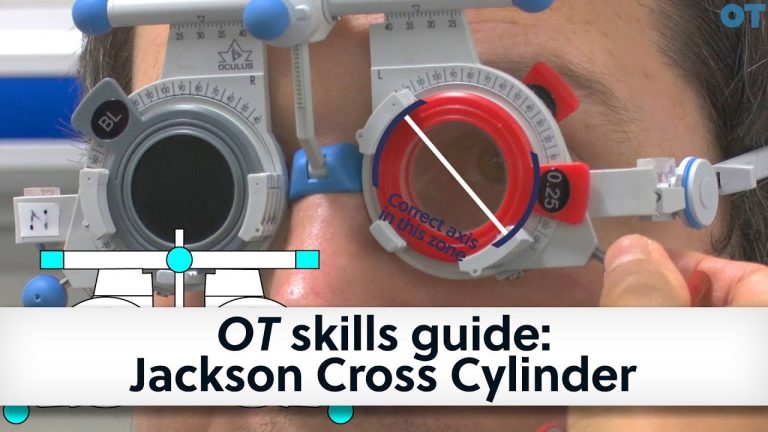 How do you check for astigmatism?