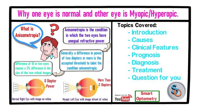 Is hyperopia Plus or minus?