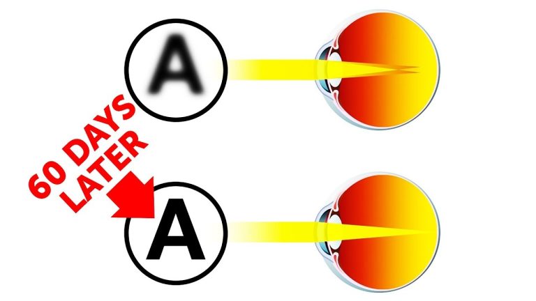 Myopic Glasses