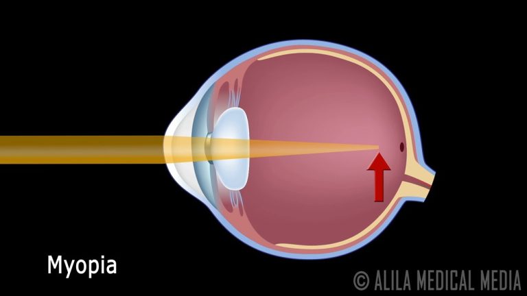 Vision Anatomy