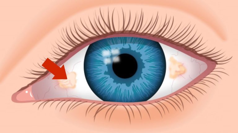 What color is the conjunctiva?