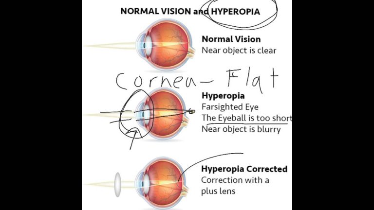 What does it mean if you are farsighted?