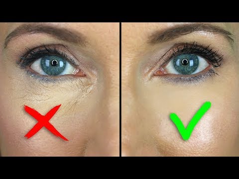 What is area under eye called?