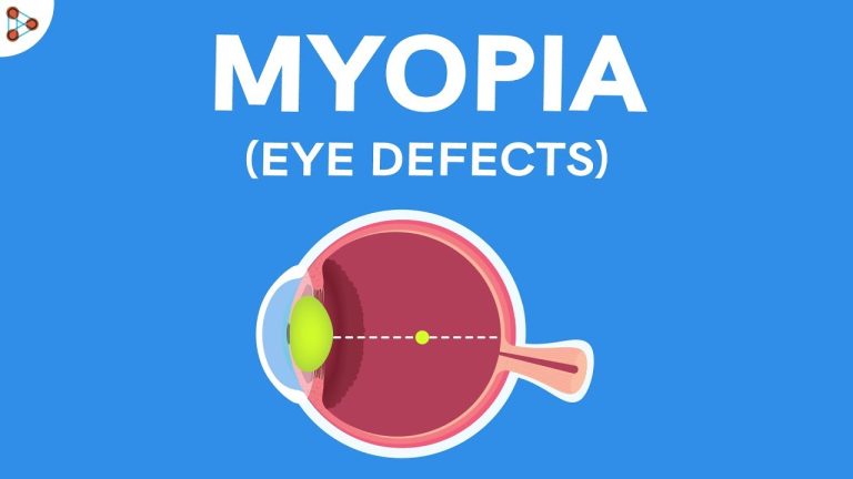 What is meant by myopia and Hypermetropia?