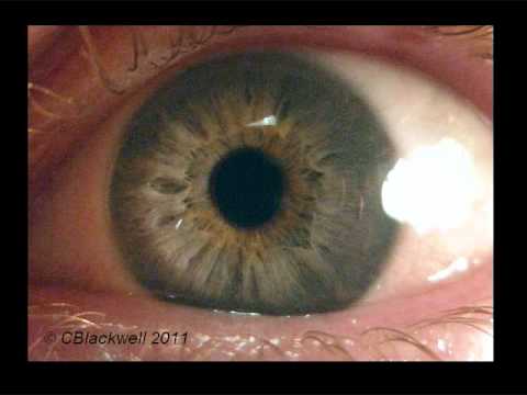 What is posterior to the iris?