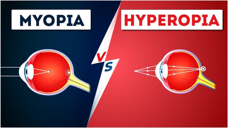 What is the difference between myopia and nearsightedness?