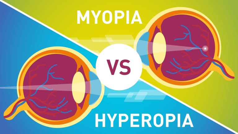 What is the difference between myopia and hyperopia?