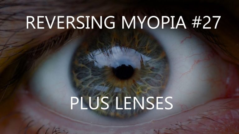 Which lens is used for myopia?