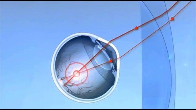 Who makes free form progressive lenses?