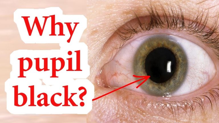 Why is a pupil black?