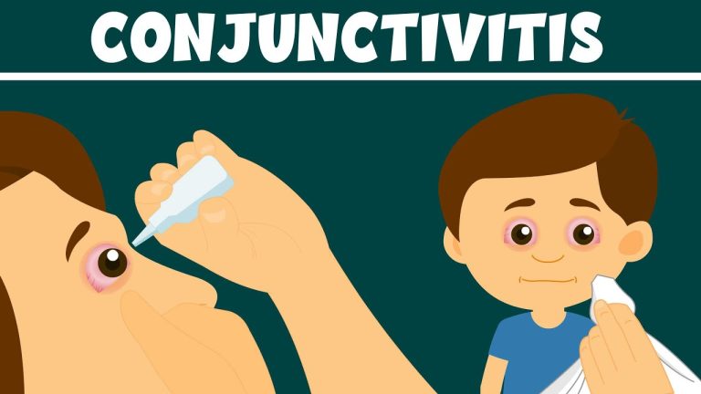 Preventing and Treating Conjunctivitis in Children: Expert Tips from Vision Care Professionals