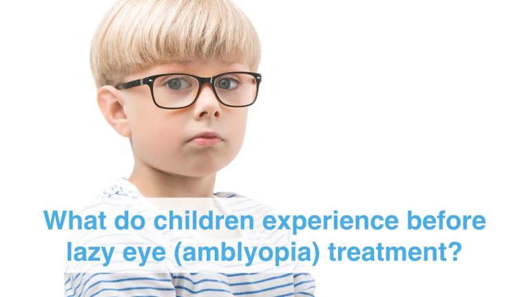 Effective and Easy Lazy Eye Treatment for Children: Improve Their Vision with These Products